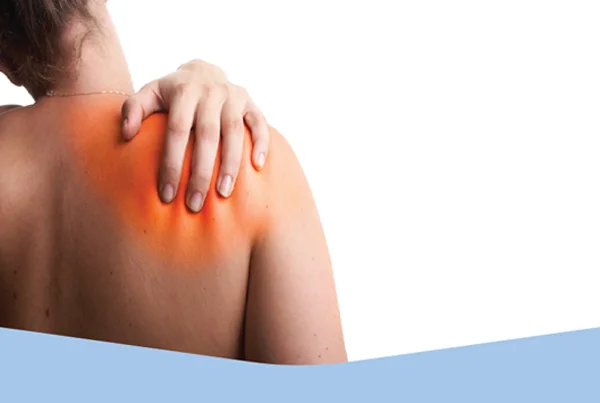 Frozen Shoulder