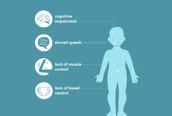 Cerebral Palsy