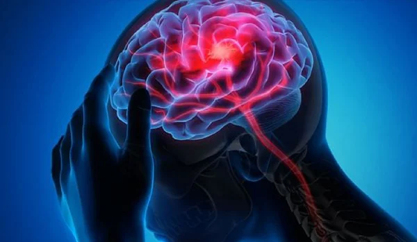 Neurological Disorders